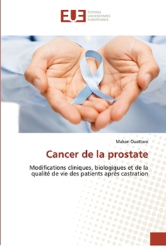 Paperback Cancer de la prostate [French] Book