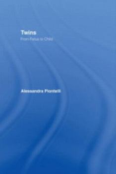 Hardcover Twins - From Fetus to Child Book