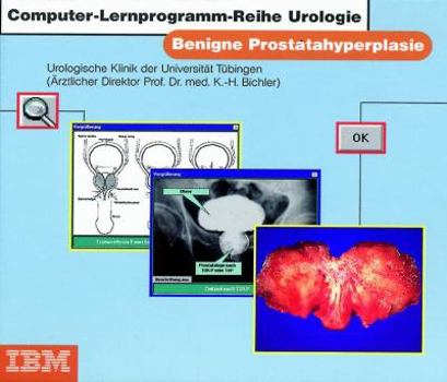 Audio CD Benigne Prostatahyperplasie [German] Book