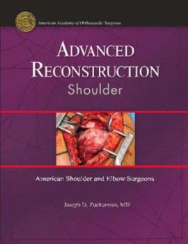 Hardcover Advanced Reconstruction: Shoulder Book