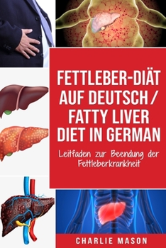 Paperback Fettleber-Diät Auf Deutsch/ Fatty liver diet In German: Leitfaden zur Beendung der Fettleberkrankheit [German] Book