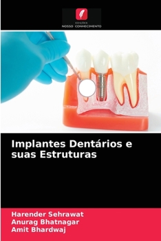 Paperback Implantes Dentários e suas Estruturas [Portuguese] Book