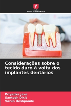 Paperback Considerações sobre o tecido duro à volta dos implantes dentários [Portuguese] Book