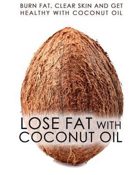 Paperback Lose Fat With Coconut Oil: Burn Fat, Clear Skin And Get Healthy With Coconut Oil Book