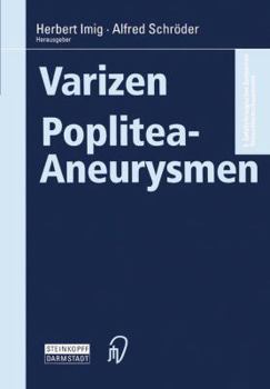 Paperback Varizen - Poplitea-Aneurysmen [German] Book