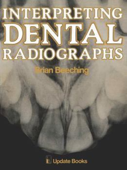 Hardcover Interpreting Dental Radiographs Book