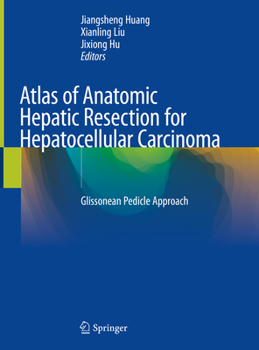 Hardcover Atlas of Anatomic Hepatic Resection for Hepatocellular Carcinoma: Glissonean Pedicle Approach Book