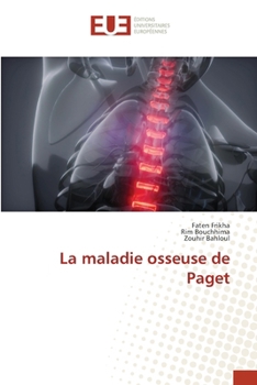La maladie osseuse de Paget (French Edition)
