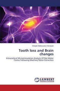 Paperback Tooth Loss and Brain Changes Book