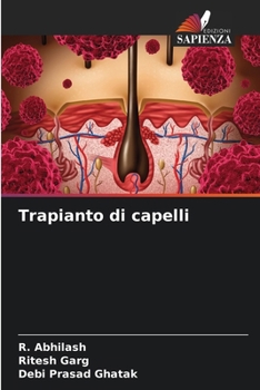 Paperback Trapianto di capelli [Italian] Book