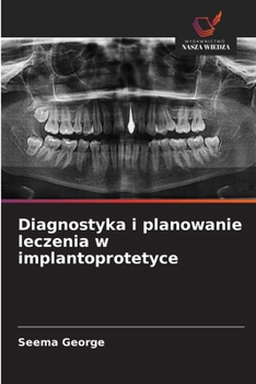 Diagnostyka i planowanie leczenia w implantoprotetyce (Polish Edition)