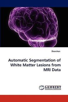 Paperback Automatic Segmentation of White Matter Lesions from MRI Data Book