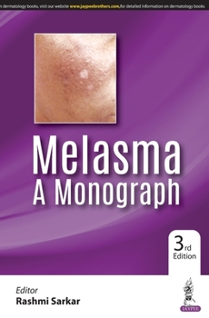 Paperback Melasma: A Monograph Book