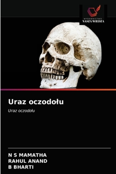 Paperback Uraz oczodolu [Polish] Book