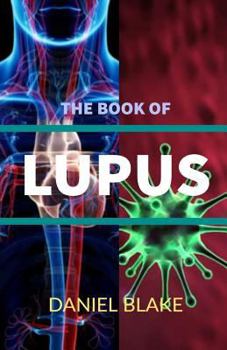 Paperback The Book of Lupus Book