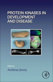 Hardcover Protein Kinases in Development and Disease: Volume 123 Book