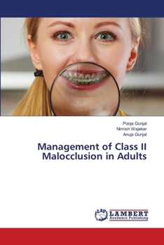 Paperback Management of Class II Malocclusion in Adults Book