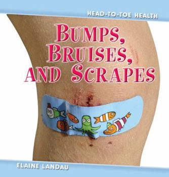 Library Binding Bumps, Bruises, and Scrapes Book