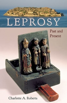 Hardcover Leprosy: Past and Present Book