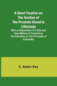 Paperback A Short Treatise on the Section of the Prostate Gland in Lithotomy;With an Explanation of a Safe and Easy Method of Conducting the Operation on the Pr Book