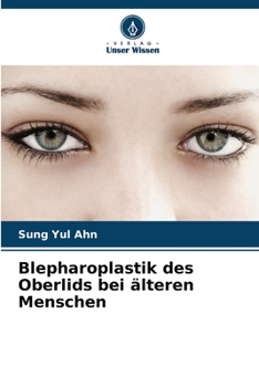Paperback Blepharoplastik des Oberlids bei älteren Menschen [German] Book