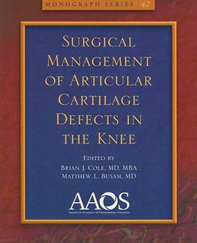 Paperback Surgical Management of Articular Cartilage Defects in the Knee Book