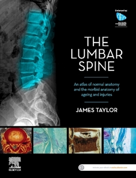 Anatomy of the Lumbar Spine: An Atlas of Normal Anatomy and the Morbid Anatomy of Ageing and Injury