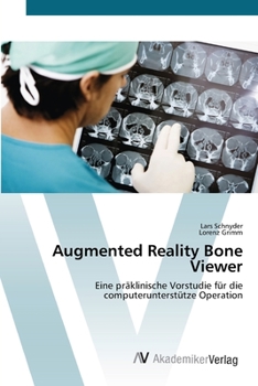 Paperback Augmented Reality Bone Viewer [German] Book