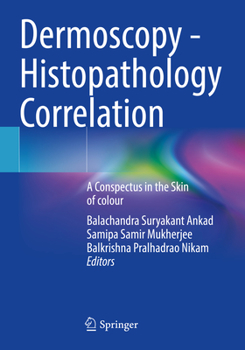 Paperback Dermoscopy - Histopathology Correlation: A Conspectus in the Skin of Colour Book
