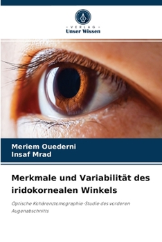 Paperback Merkmale und Variabilität des iridokornealen Winkels [German] Book