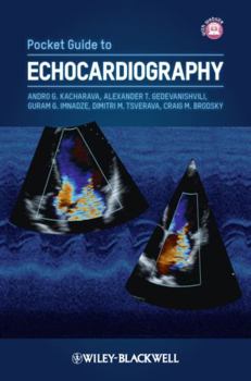 Paperback Pocket Guide to Echocardiography Book