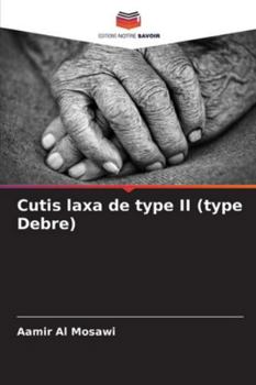 Cutis laxa de type II (type Debre) (French Edition)