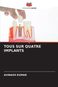 Paperback Tous Sur Quatre Implants [French] Book