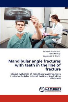 Paperback Mandibular angle fractures with teeth in the line of fracture Book