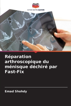 Paperback Réparation arthroscopique du ménisque déchiré par Fast-Fix [French] Book