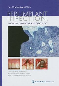 Hardcover Peri-Implant Infection: Etiology, Diagnosis and Treatment Book