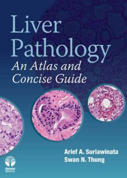Paperback Liver Pathology : An Atlas and Concise Guide Book