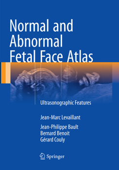 Paperback Normal and Abnormal Fetal Face Atlas: Ultrasonographic Features Book
