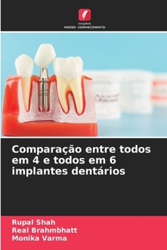 Paperback Comparação entre todos em 4 e todos em 6 implantes dentários [Portuguese] Book