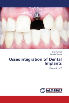 Osseointegration of Dental Implants: From A to Z