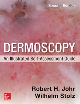 Paperback Dermoscopy: An Illustrated Self-Assessment Guide, 2/E Book
