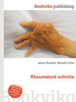 Paperback Rheumatoid Arthritis Book