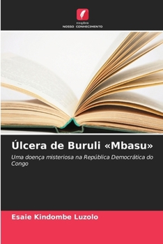 Paperback Úlcera de Buruli Mbasu [Portuguese] Book