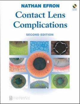 Hardcover Contact Lens Complications Book