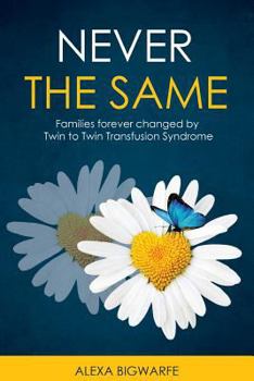 Paperback Never the Same: Families Forever Changed by Twin to Twin Transfusion Syndrome Book