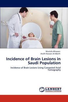 Paperback Incidence of Brain Lesions in Saudi Population Book