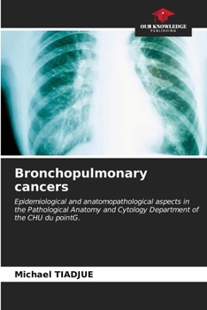 Paperback Bronchopulmonary cancers Book