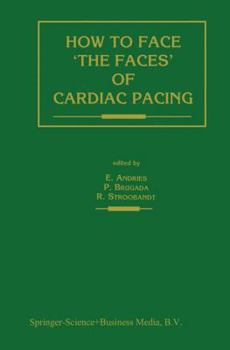 Paperback How to Face 'The Faces' of Cardiac Pacing Book