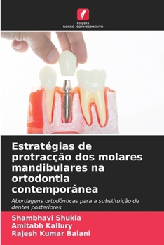 Paperback Estratégias de protracção dos molares mandibulares na ortodontia contemporânea [Portuguese] Book