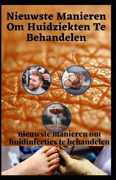 Nieuwste Manieren Om Huidziekten Te Behandelen: 28 nieuwste manieren om huidinfecties te behandelen